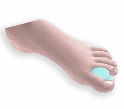 Actius Separador Carrete em Gel
