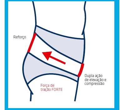 Pavis Slip ERNIABLOCK - Contenção Forte